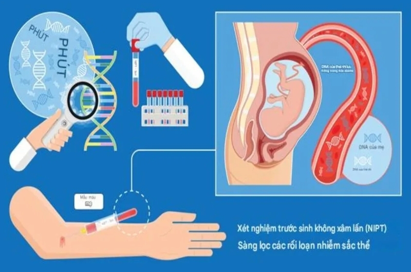 Sàng lọc thai kỳ giúp đánh giá nguy cơ mắc Down, trong khi chẩn đoán xác định cần xét nghiệm chuyên sâu. 