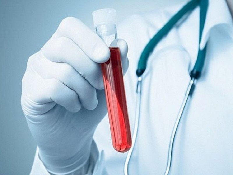Kiểm tra chỉ số TSH và hormone T3, T4 là bước quan trọng để chẩn đoán chính xác tình trạng bệnh.