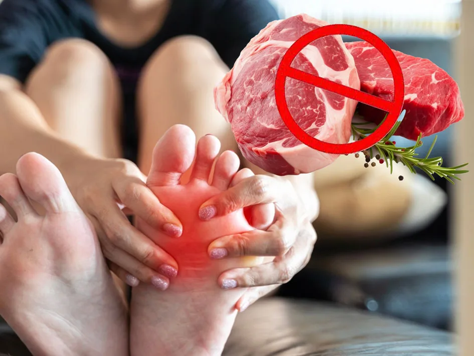 Bệnh gout kiêng ăn gì
