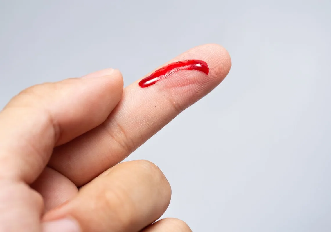 Mơ thấy bị chó cắn